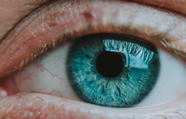Foto: pexels.com